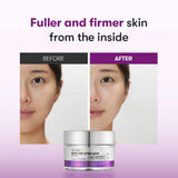 Liftinga krēms ar mikroadatām VT Cosmetics Reedle Shot Lifting Cream