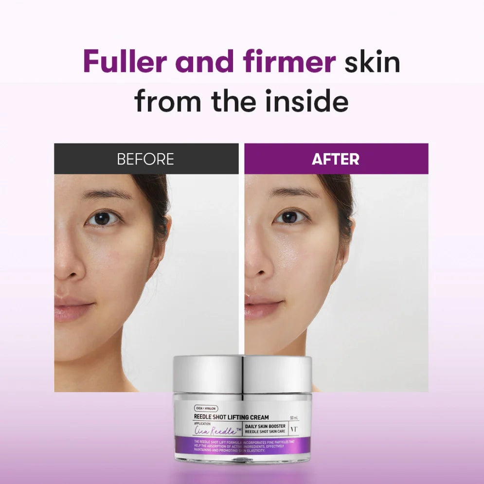 Liftinga krēms ar mikroadatām VT Cosmetics Reedle Shot Lifting Cream