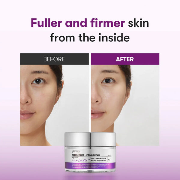 Liftinga krēms ar mikroadatām VT Cosmetics Reedle Shot Lifting Cream